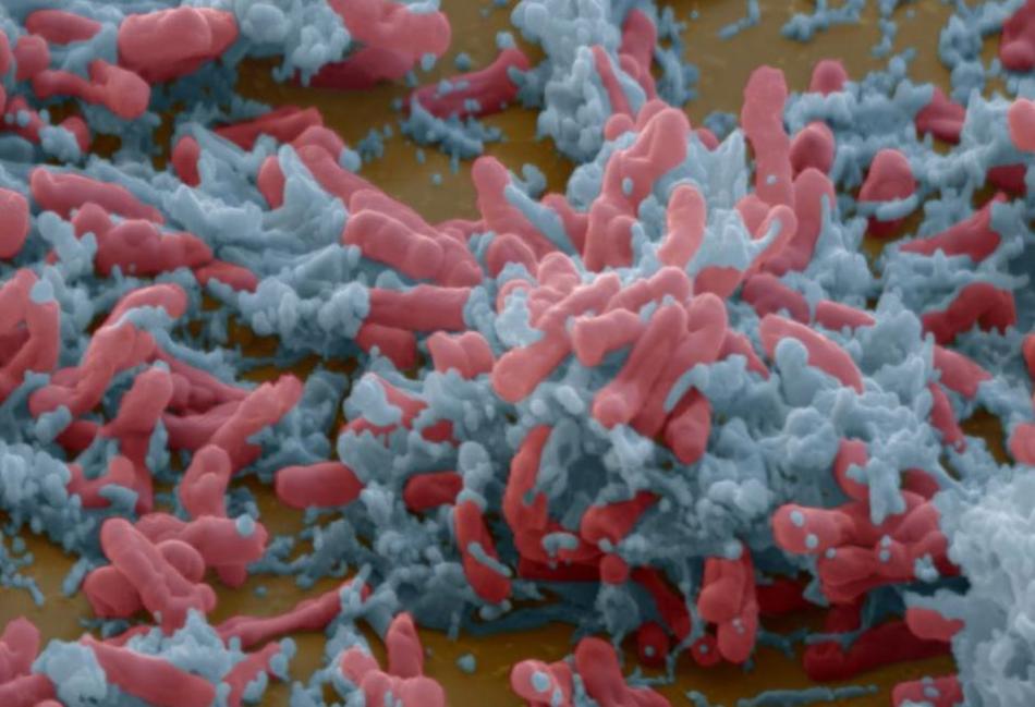 显微镜展致命细菌真面目:SARS病毒可刺透宿主