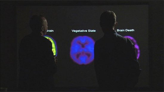 科学家通过大脑扫描首次实现与植物人沟通